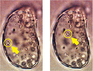 Granule